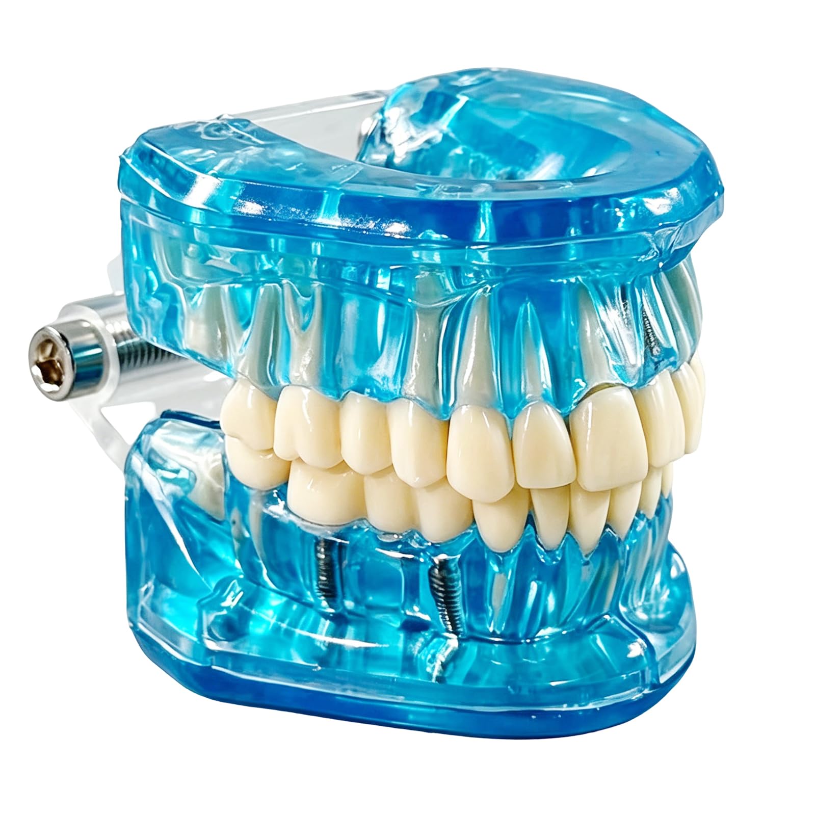 Zahnmodell mit Herausnehmbaren ZäHnen, Zahnimplantat Zahnmodell,Transparentes Modell Erkrankter ZäHne, modell für Zahnarzt, Dental Model für Demonstrationen und Studien(Blau)