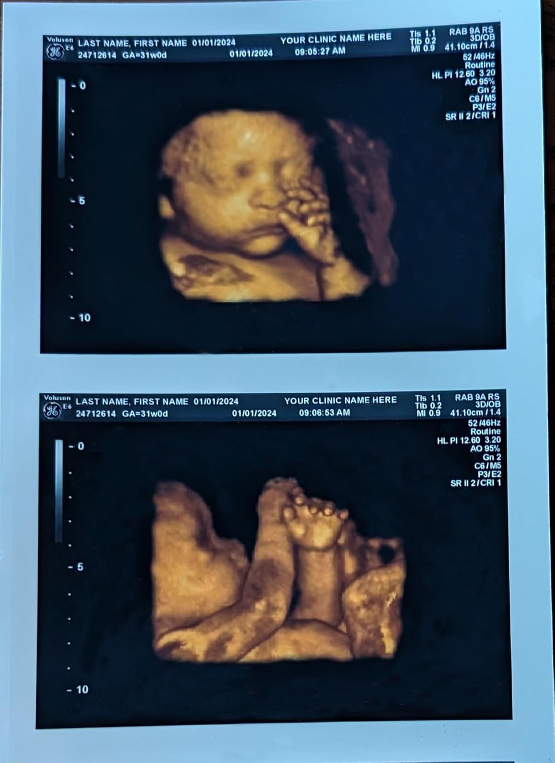Prank 3D COLOR Customized Fake Ultrasound Strip of 2 Photos