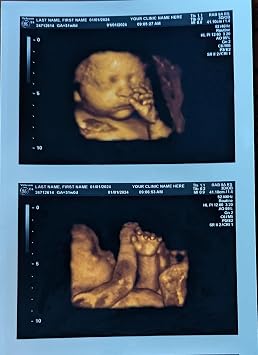 Prank 3D COLOR Customized Fake Ultrasound Strip of 2 Photos