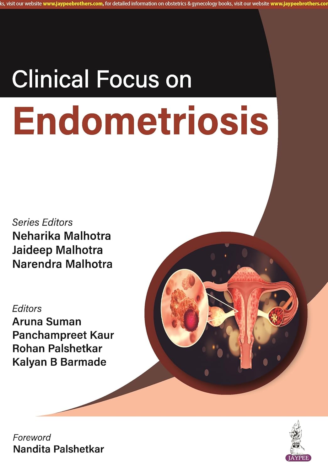 Clinical Focus on Endometriosis      [Print Replica] Kindle Edition