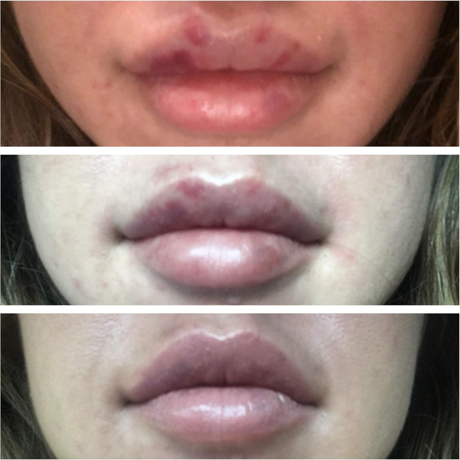 Arnica 1,000mg and Bromelain 500mg 2,400GDU/g Nepal Ubuy