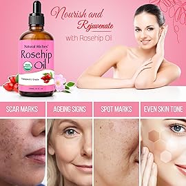 Natural Riches Organic Rosehip Seed Oil for Face 100% Pure Natural Cold Pressed Unrefined Non-GMO Carrier Oil for Skin Hair & Nails. 4 fl oz.