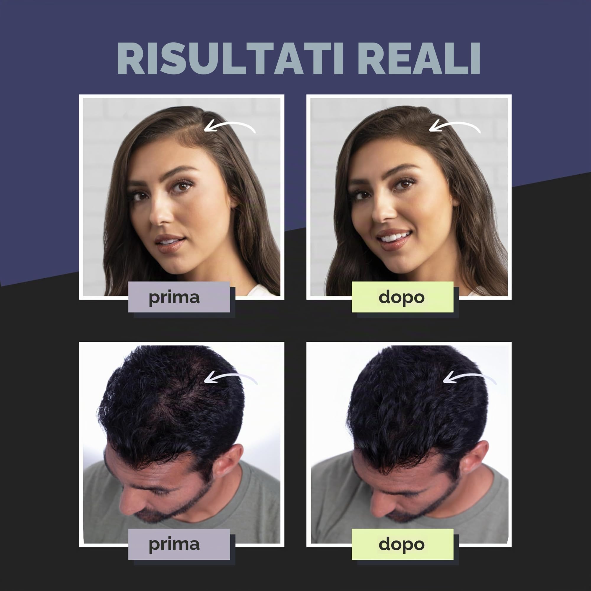 Toppik Fibre di cheratina per la costruzione dei capelli, Nero (Black), 55 g - etichetta in lingua Italiana