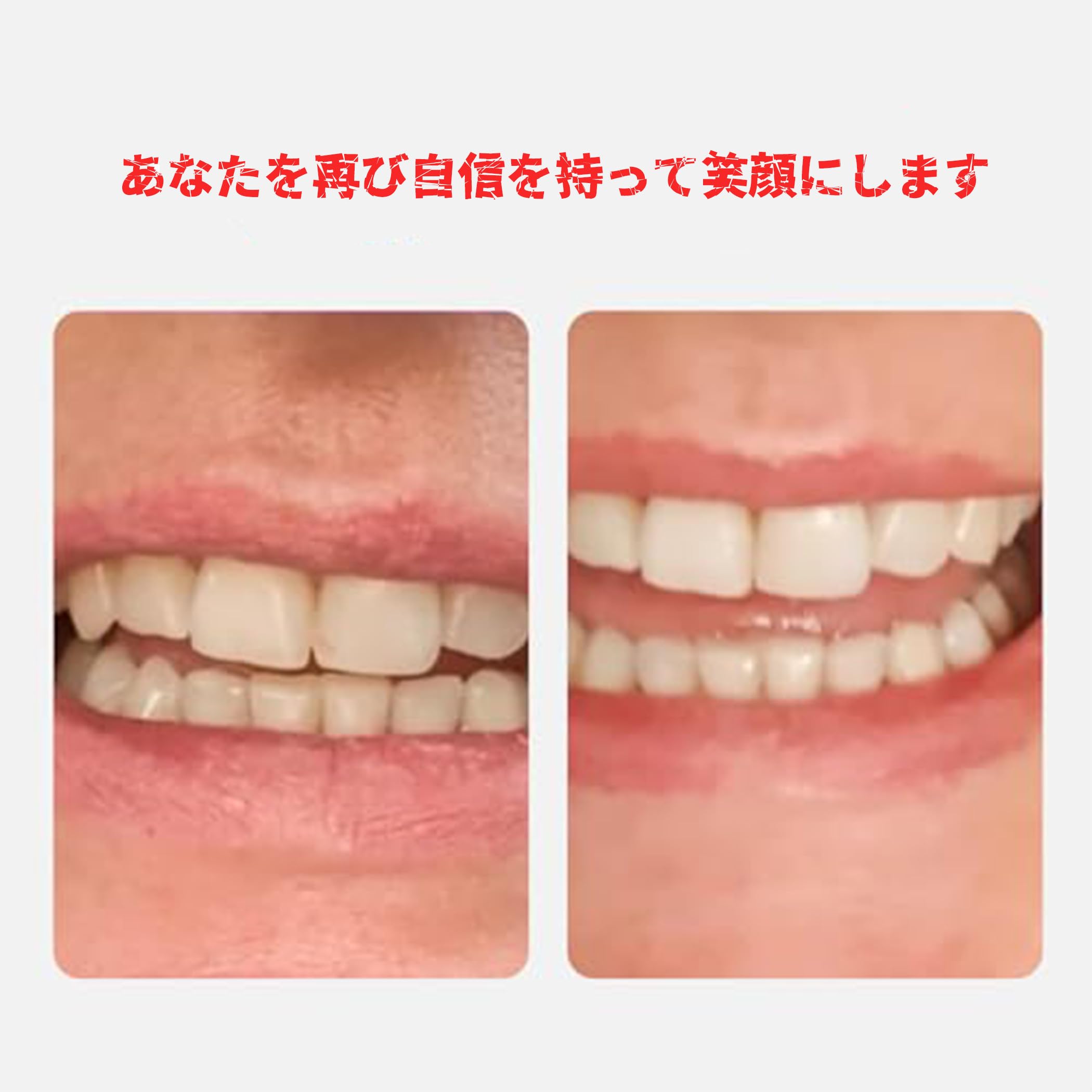 Amazon | Krasada自作のシンプルな入れ歯|入れ歯、入れ歯の前歯|上下に