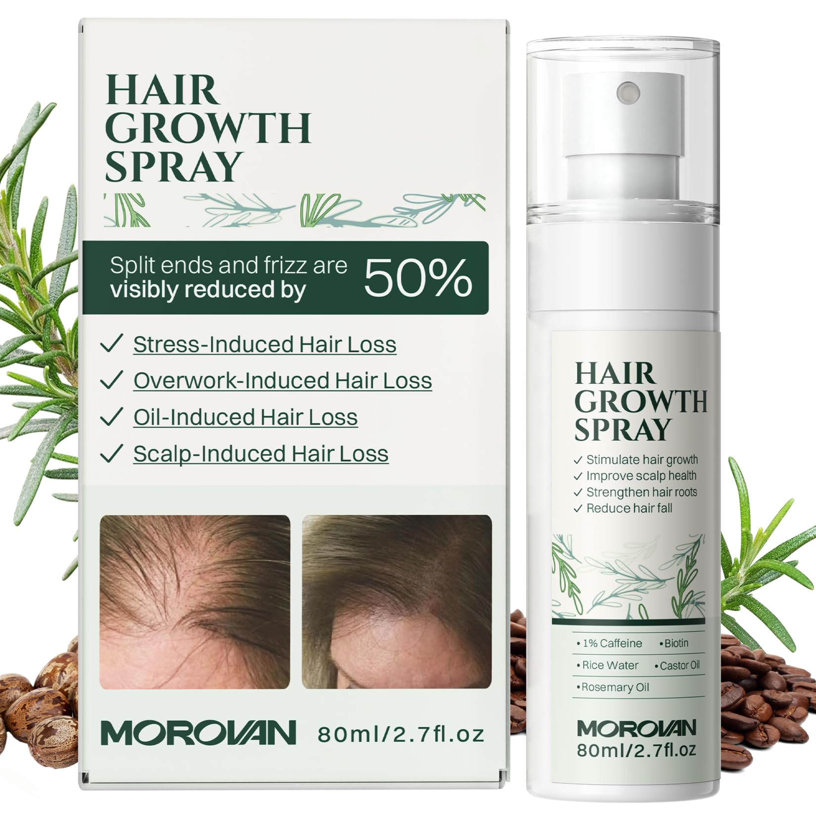 Morovan Hair Growth Spray for Scalp: 30 Days Hair Loss Reduction & Hair Growth with Batana and Castor Oil for Thinning Hair & Damaged Hair & Severe Hair Loss-2.7 fl oz