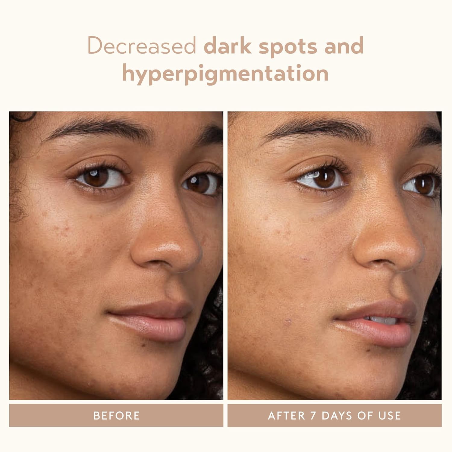 SHANI DARDEN SKIN CARE Lactic Acid Face Serum, Active Night Serum to Help with the Look of Radiant and Smooth Skin, Gentle But Powerful Face Exfoliator, 1.01 fl oz