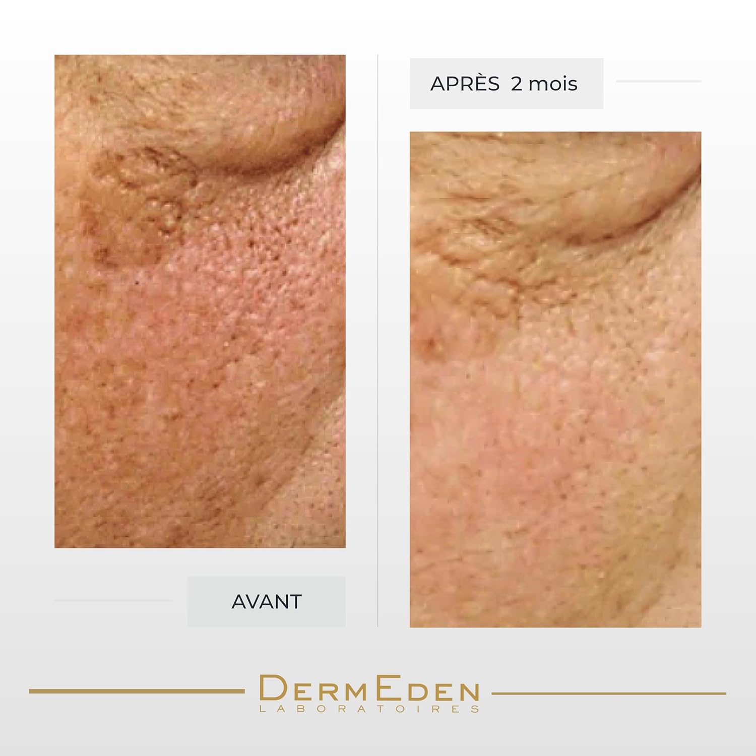 DERMEDEN NIGHT PROTOCOLE INTENSE ANTI-AGEING EYE CONTOUR CREAM 15ML …