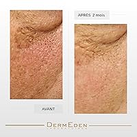 Vista 2 de DERMEDEN CREMA CONTORNO DE OJOS INTENSA NIGHT PROTOCOLE ANTI-AGE 15ML