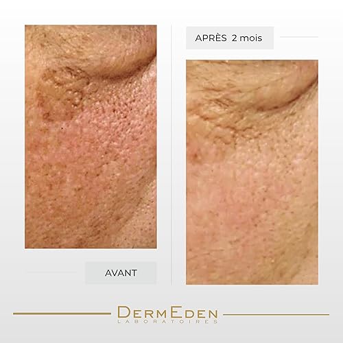 Miniatura 2 de DERMEDEN CREMA CONTORNO DE OJOS INTENSA NIGHT PROTOCOLE ANTI-AGE 15ML …