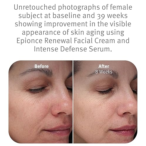 Miniatura 4 de Epionce Crema facial Renewal - Hidratante hidratante antienvejecimiento | Para pieles secas y sensibles a la normal | Líneas finas y arrugas |