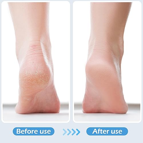 Miniatura 5 de 3 cepillos 4 en 1 para pies para uso en la ducha con piedra pómez, raspador de pies y papel de lija, cepillo de limpieza de pies para pies,