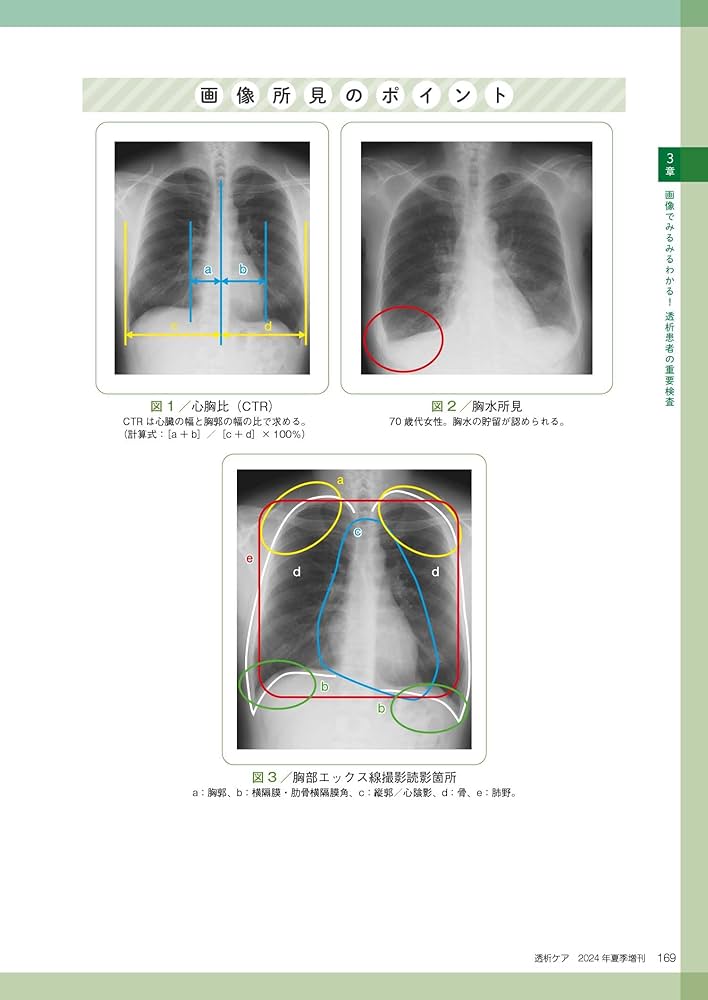 透析ケア　4冊まとめ 透析患者の検査値＆画像:ぱっと見てわかる！説明できる！ (透析