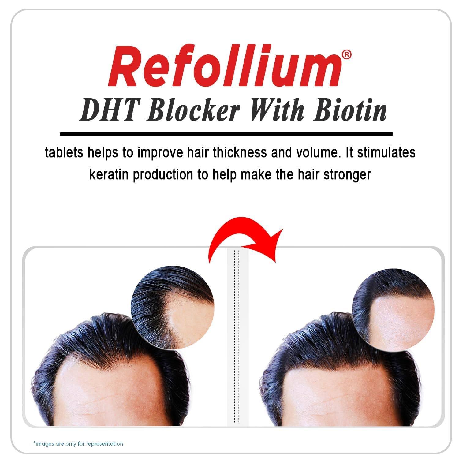 Refollium DHT Blocker with Biotin | Helps Reduce Hair Fall, Stimulates Hair Growth | Hair Vitamins for Men & Women (30 Tablets) (DHT BLOCKER) (Biotin + Hair Vitamins) — Amazon image 9