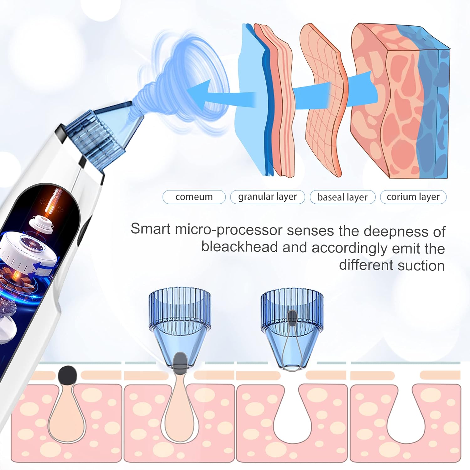 Blackhead Remover Pore Vacuum - Upgraded Electric Pore Cleaner Blackhead Removal Tool with 5 Adjustable Suction Power and 4 Suction Probes, USB Rechargeable Pore Vacuum Removal for Whitehead (White) : Beauty & Personal Care