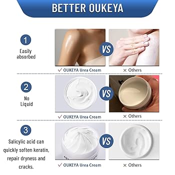 ※ Uo・ェ・oU　テリア※ Amazon.com : OUKEYA Urea Cream 42% plus Salicylic Acid 2