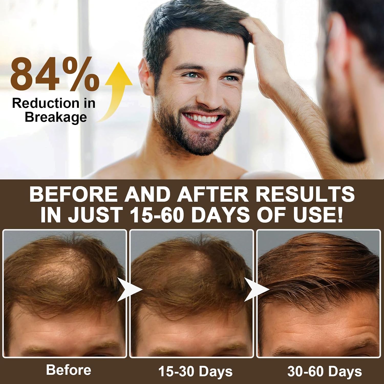 Caffeine & Biotin Shampoo 10.56 fl oz(Pack of 1), Hair Growth Shampoo with Caffeine, Castor Oil, Peppermint Extract | Promotes Natural Hair Growth and Thickness, Energizes Scalp.