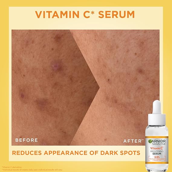 Garnier Vitamin C Serum & SPF Set