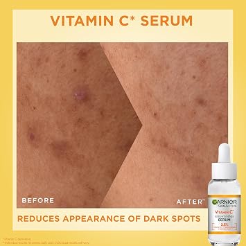 Garnier Vitamin C Serum & SPF Set