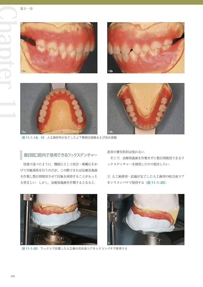 60年の臨床から導き出した阿部晴彦の総義歯臨床 | 阿部 晴彦