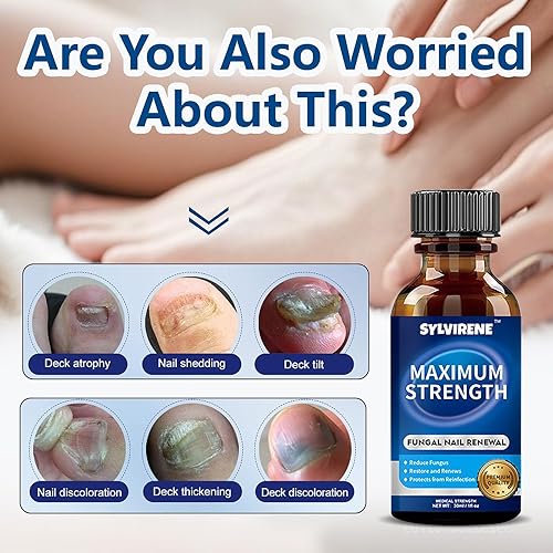 Miniatura 2 de Tratamiento de hongos en las uñas de los pies extra fuerte, 30ML líquido de reparación de uñas de hongos con 1% de tolnaftate, tratamiento de acción