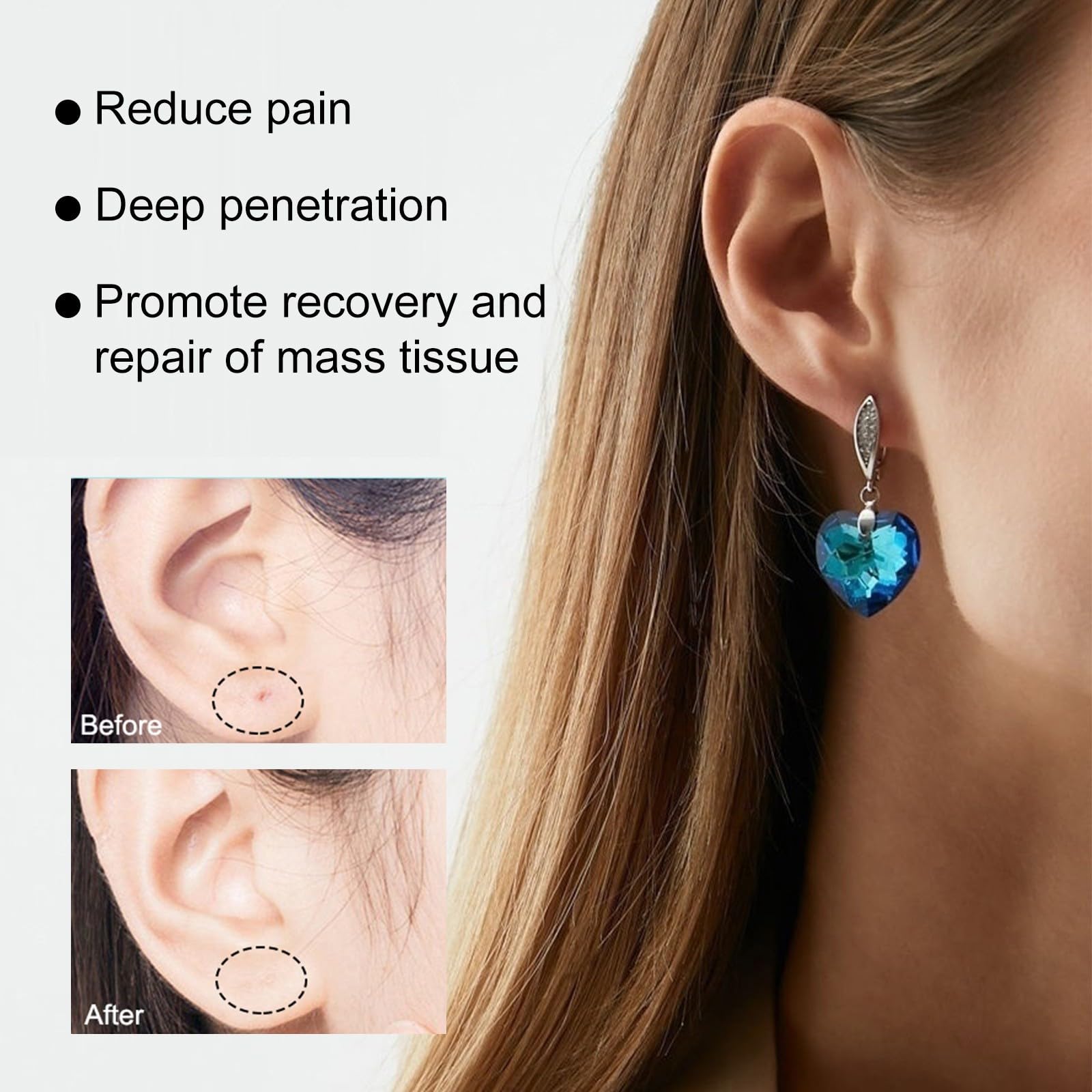 Piercing-Set, die Beschwerden von Ohrpiercing, Ohrpiercing-Lösung, 60 ml + Piercing-Bump-Lösung, 10 ml Ohr-Licht-Plektrum