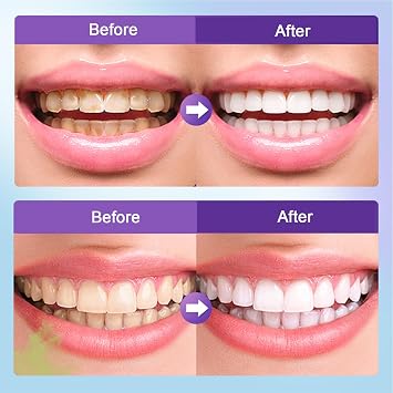 Microcrystalline Hydroxyapatite Powder, Microcrystalline Hydroxyapatite, 50g Hydroxyapatites Toothpaste, Stain Removal, Fresh Breath
