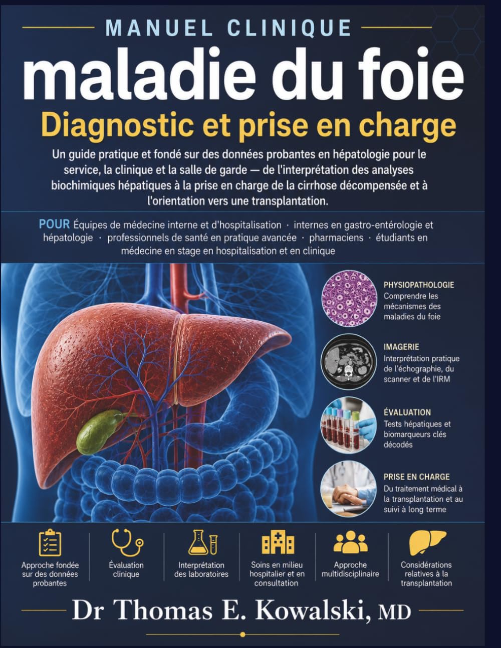 maladie du foie Diagnostic et prise en charge