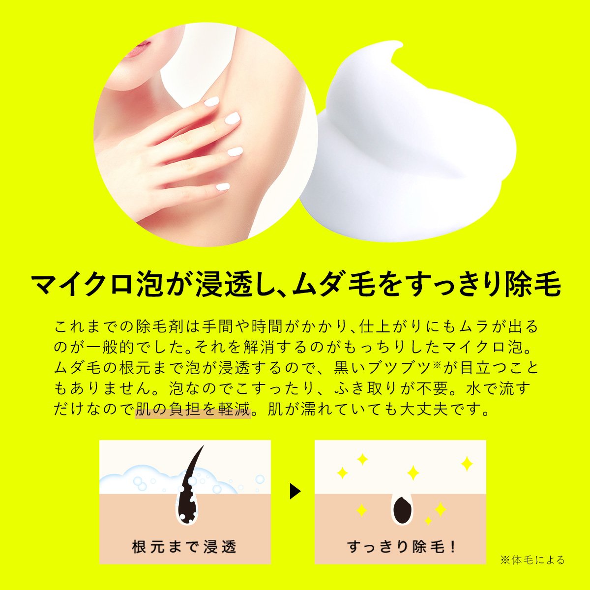 Amazon.co.jp: 【旧品】ボディプレックス ホイップリムーバー 除毛
