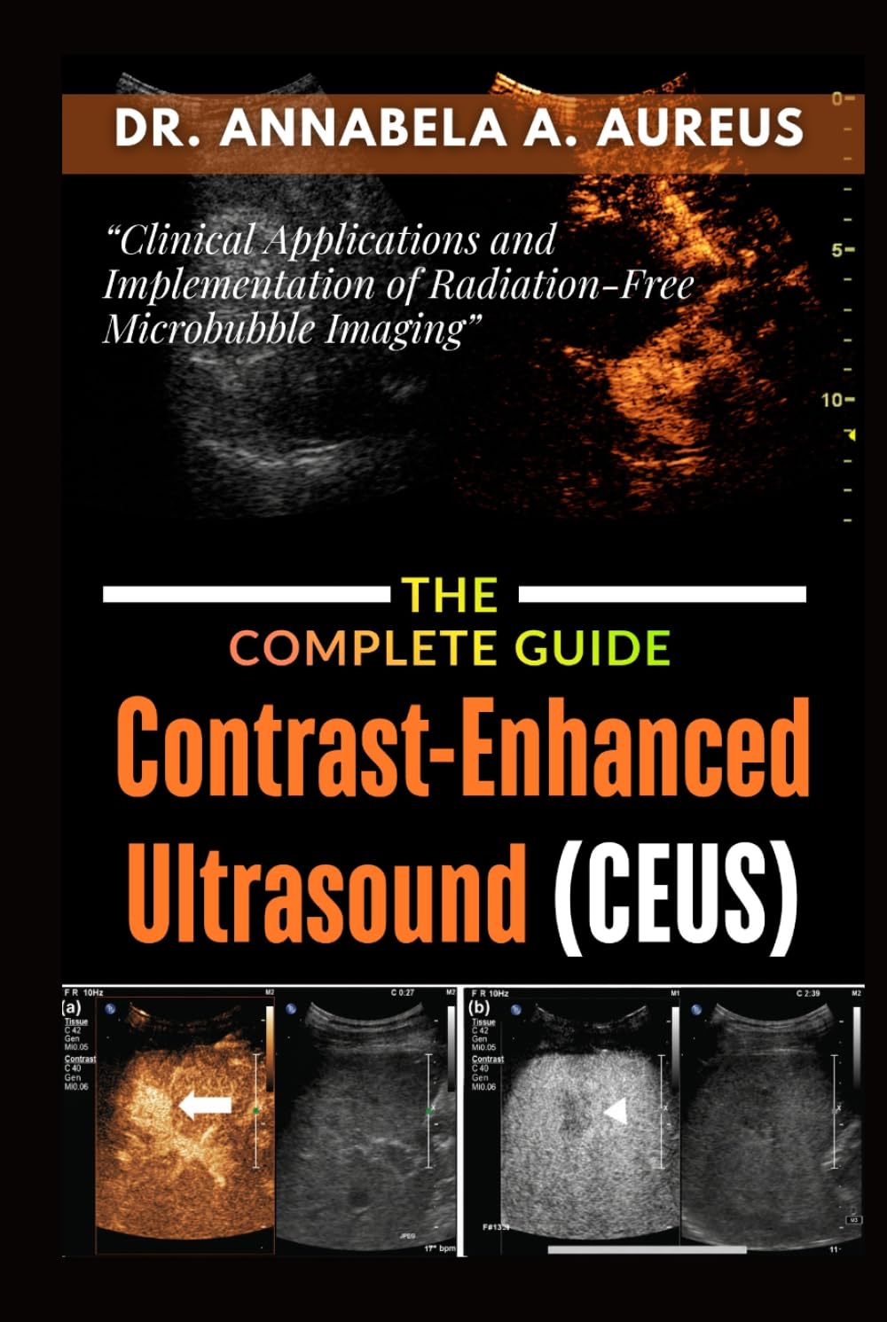 Contrast-Enhanced Ultrasound (CEUS): The Complete Guide: Clinical Applications and Implementation of Radiation-Free Microbubble Imaging (The Ultrasound Mastery Series)