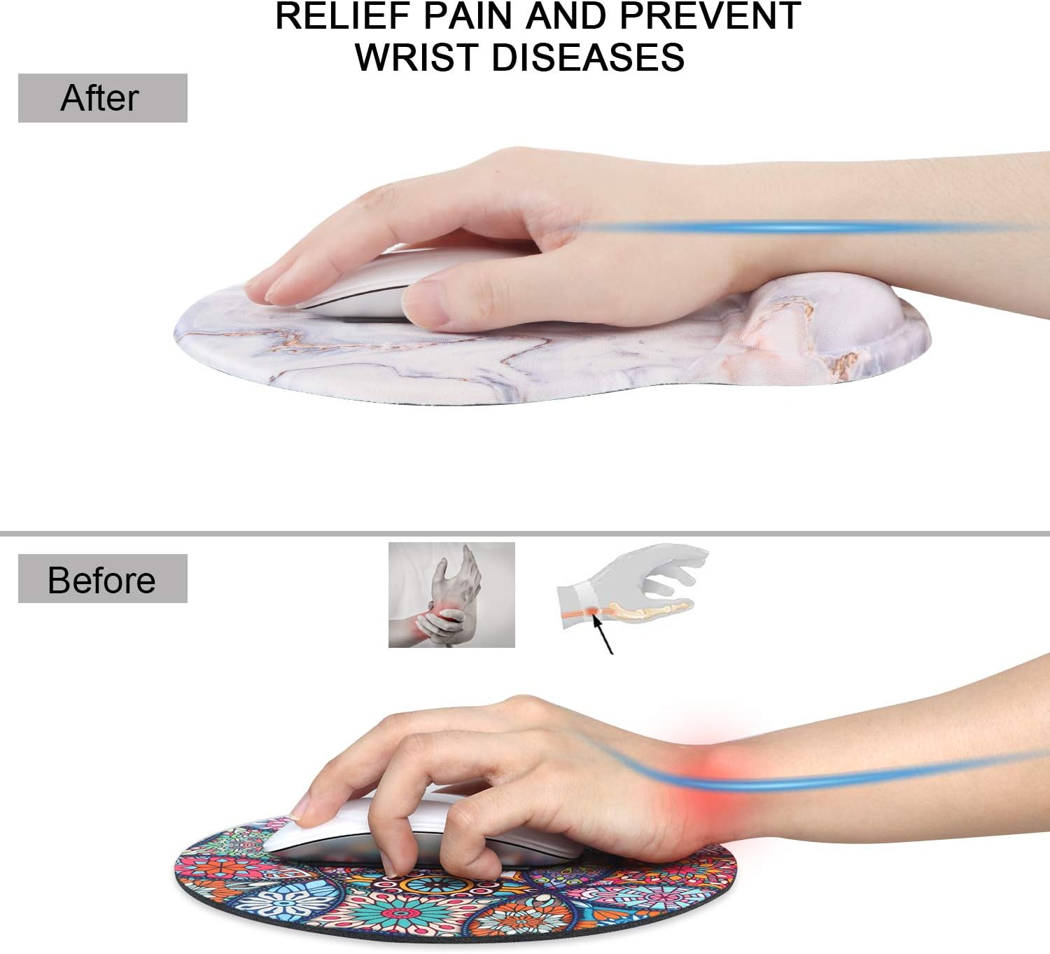 iCasso Mouse Pad, Ergonomic Mouse Pad with Gel Wrist Rest Support, Durable & Comfortable Large Non-Slip Pain Relief Mousepad for Office, Home - Easy Typing and Gaming (White Marble)
