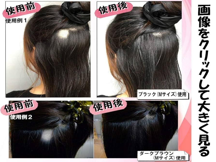 Amazon.co.jp: 円形脱毛症隠し 部分かつら チュールキュア(M