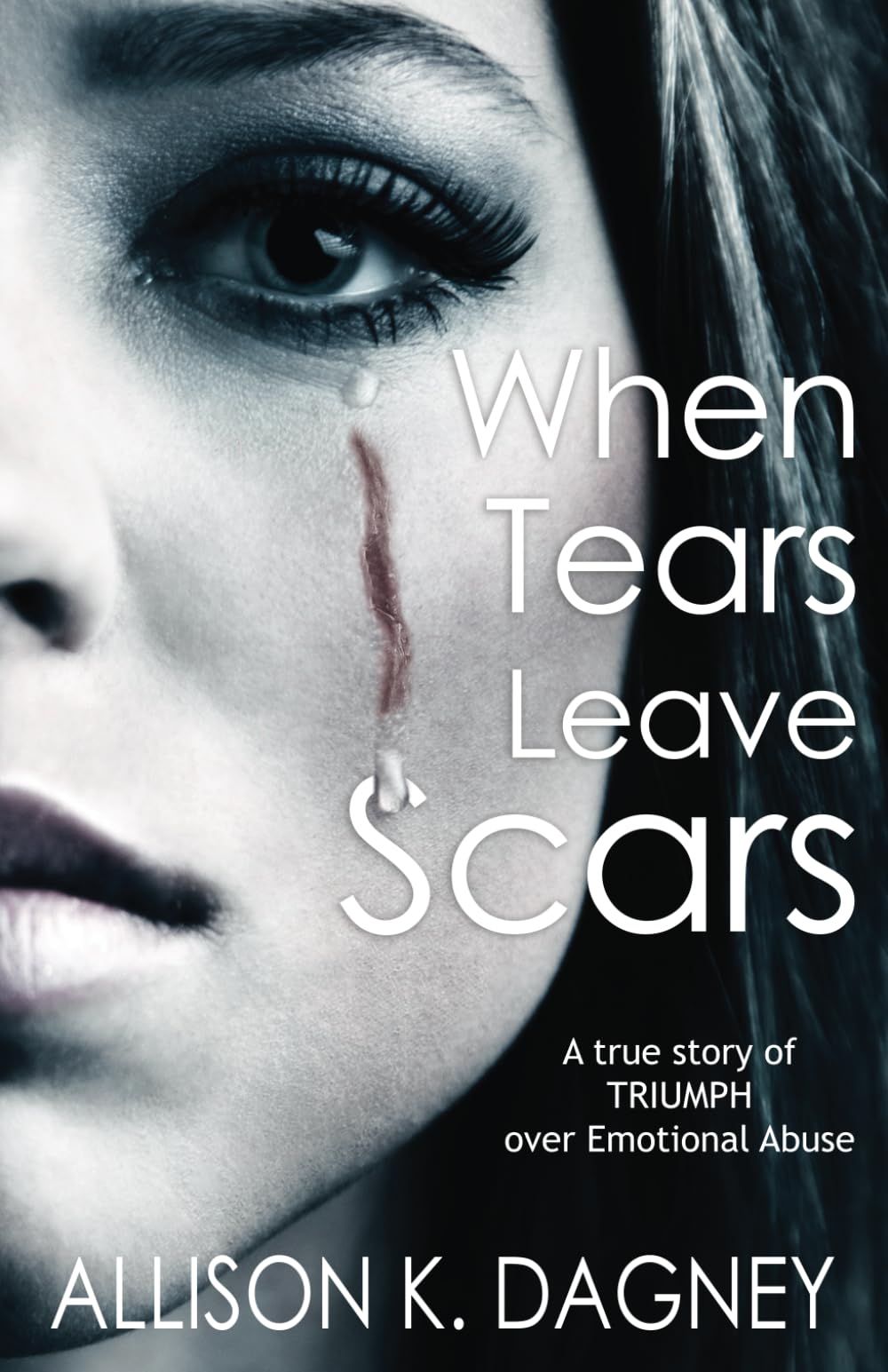 When Tears Leave Scars: A True Story of Triumph Over Emotional Abuse