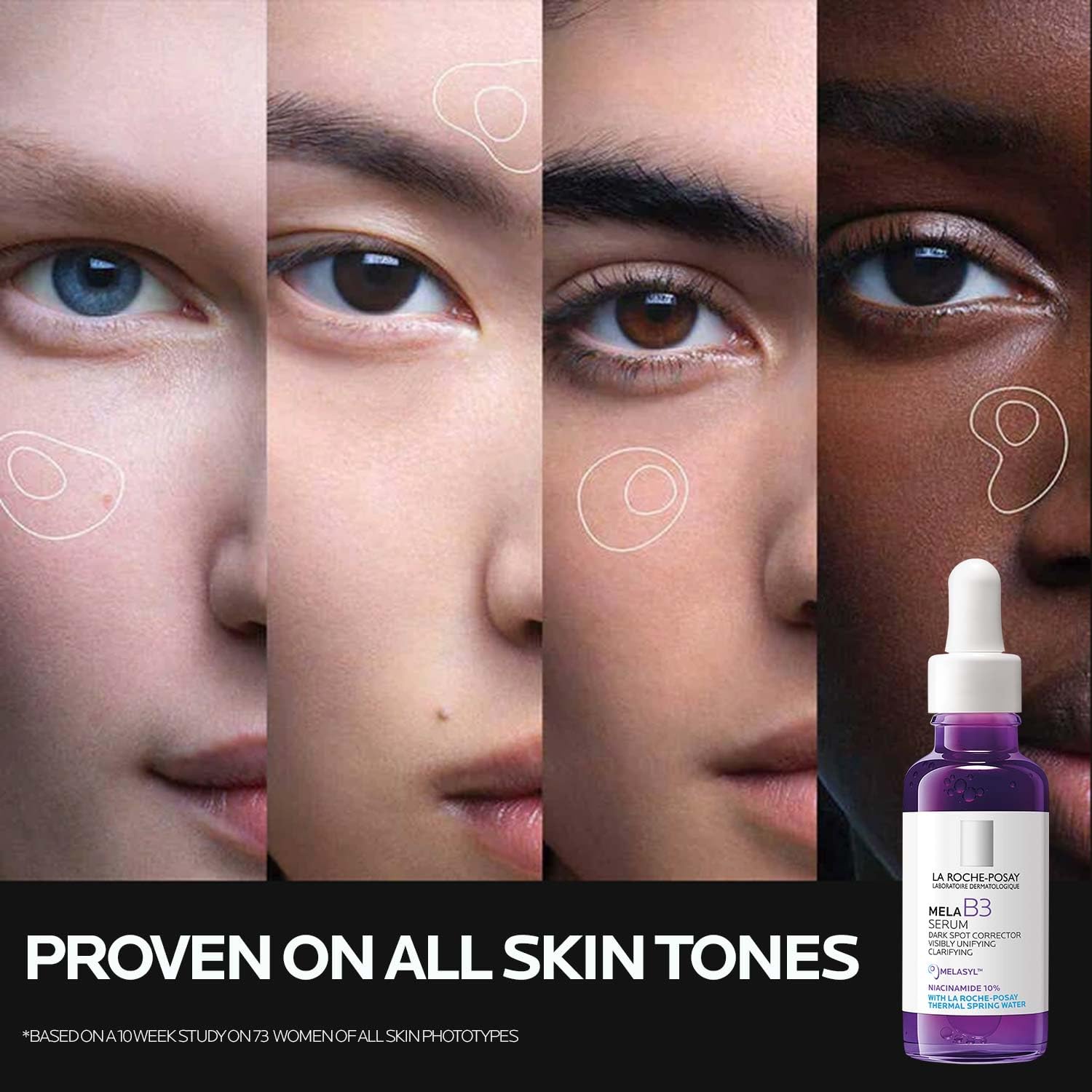 La Roche-Posay Mela B3 Serum, Dark Spot Corrector With Anti-Aging Melasyl + 10% Niacinamide, Discoloration Correcting Serum for Sun Spots, Age Spots & Post-Acne Marks: 1 Fl Oz (Pack of 1)