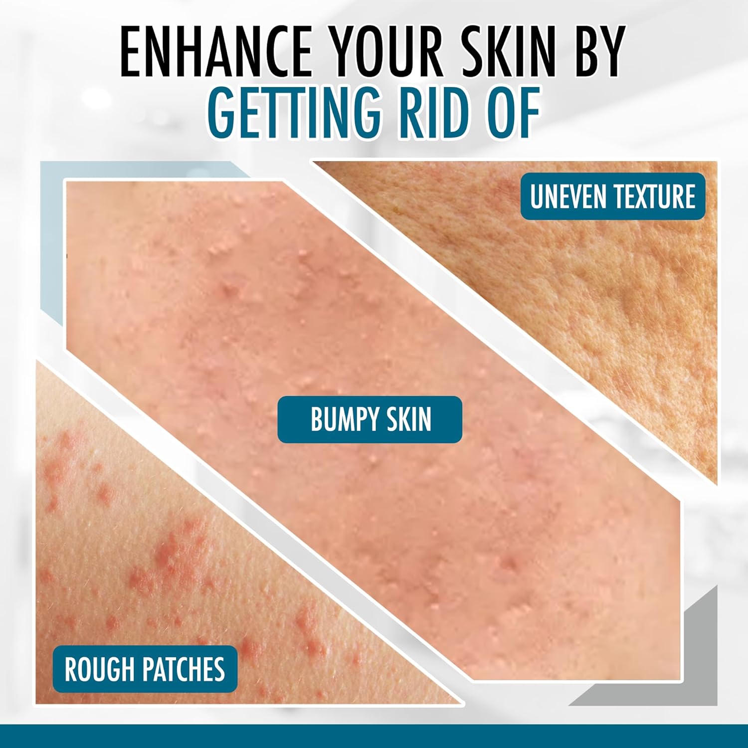 GLY MIRACLE Moisturizing Body Lotion Non-Greasy Skin Humectant for Extremely Dry Skin, Hands, Body, and Feet, Light, Fresh Scent with Pure Glycerin for Nourishing Hydration 16 oz Jar