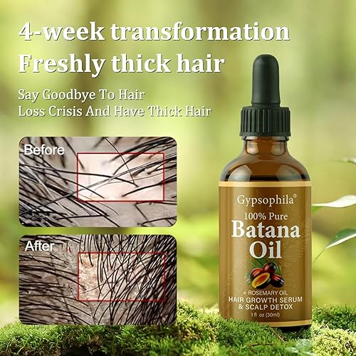 Miniatura 2 de Aceite de batana para el crecimiento del cabello, aceite natural 100% puro para el crecimiento del cabello, nutre el cuero cabelludo, elimina las