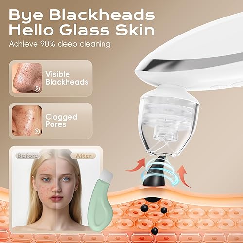 Miniatura 6 de Removedor de puntos negros faciales, extractor de puntos negros, herramienta de limpieza facial con ventosa recargable, kit de limpieza de poros