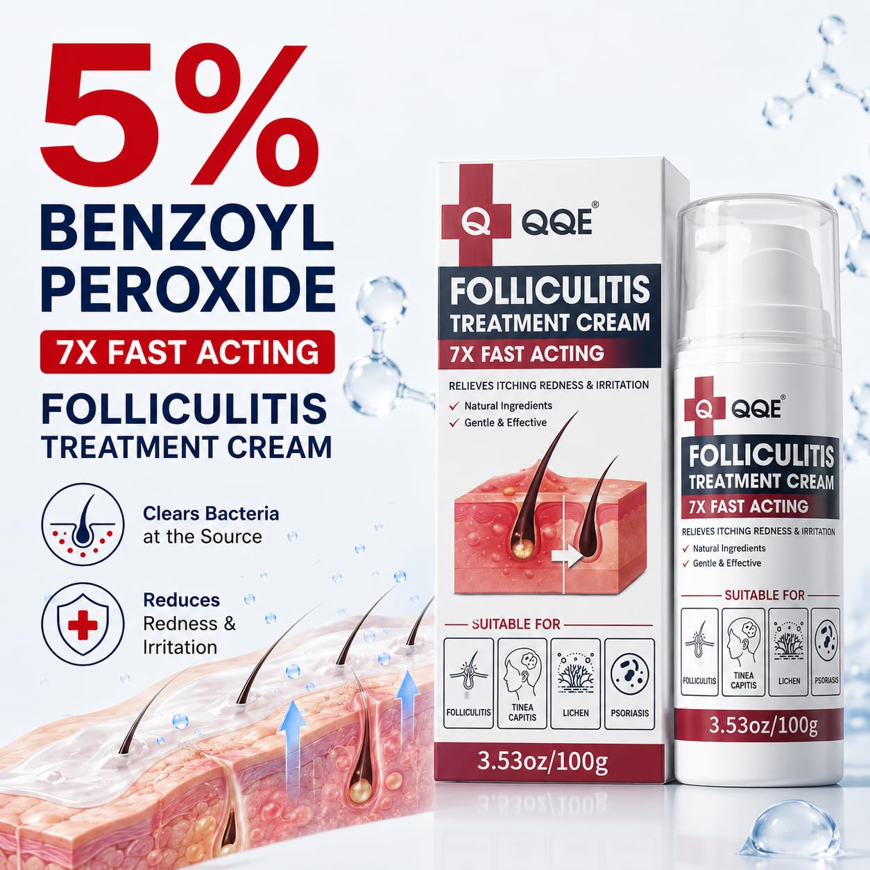 Folliculitis Treatment Cream with 5% Benzoyl Peroxide, Fast-Acting Folliculitis Cream for Scalp, Face, Chest, Back & Body, Helps Relieve Redness, Itching and Irritated Hair Follicles, 3.53 oz