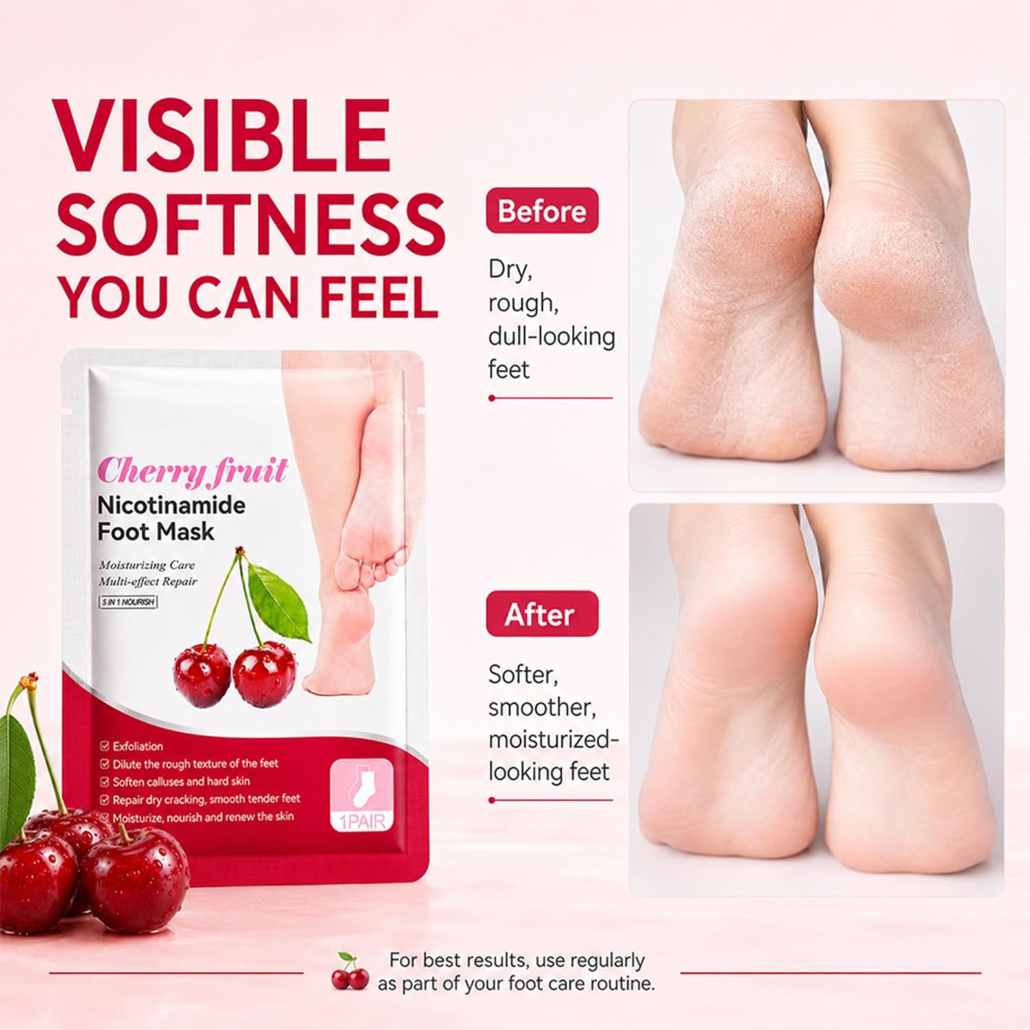 Cherry Foot Masks that Remove Dead Skin, Foot Peeling Mask Extra Strength | Foot Exfoliating Mask with Niacinamide & Sodium Hyaluronate, Moisturizing Foot Care Mask for Dry Rough Feet Soft Smooth Feel
