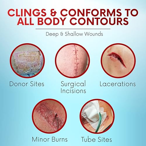 Miniatura 4 de HEALQU Medical Xeroform - Apósito de vaselina de 5 x 9  50 unidades  Almohadilla de gasa no adherente para heridas de baja exudación  Parche de gasa