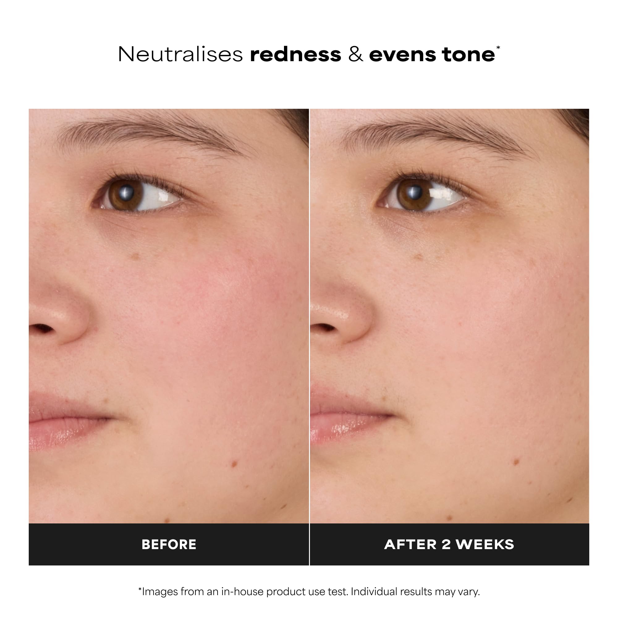 Paula's Choice SKIN BALANCING Tonik - Delikatnie Nawilżający Tonik do Twarzy Zmniejszające Rozszerzone Pory & Zwalczanie Wyprysków i Zaskórników - z Niacynamid - Skóra Mieszana i Tłusta - 190 ml | Lekki krem nawilżający zwalcza niedoskonałości i zaskórnik