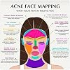 IDGTTLDF Professional Skincare Face Map Acne Zone Theory and Guide Poster Canvas Wall-Art for Clinic or Studio Decor Framed,08x12inch(20x30cm)