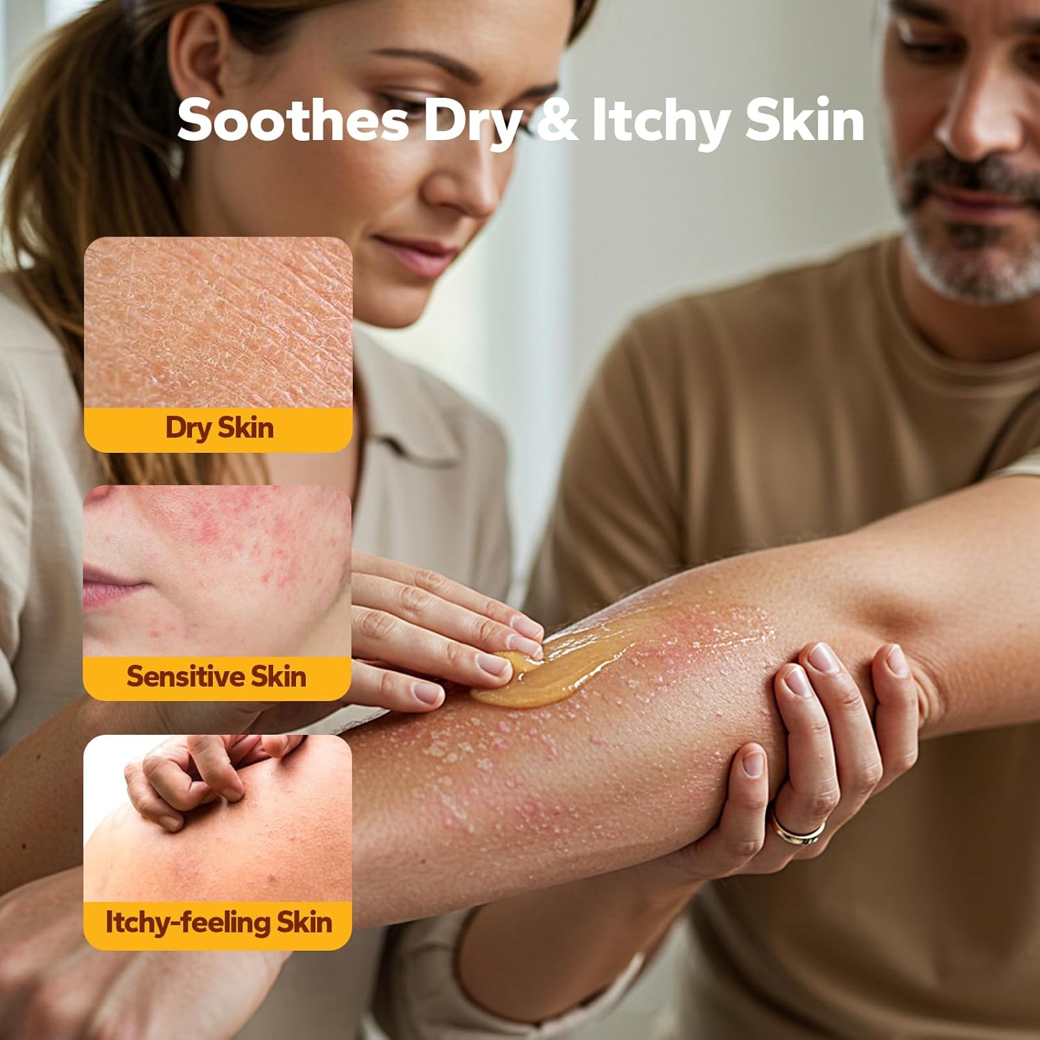 Manuka Honey Cream (4.1 Fl Oz), Eczema Cream for Adults, Eczema Lotion for Face & Body, Natural Manuka Honey Ointment for Soothing, Dry & Itchy Skin, Itchy Skin Relief Moisturizer - Image 2