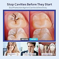 Vista 2 de Protección de la cavidad Líquido de armadura dental: fórmula respaldada por la ciencia fortalece el esmalte con gotas de remineralización Soporte