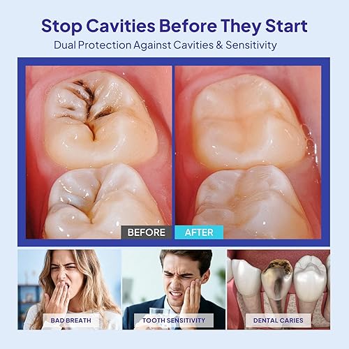 Miniatura 2 de Protección de la cavidad Líquido de armadura dental: fórmula respaldada por la ciencia fortalece el esmalte con gotas de remineralización Soporte