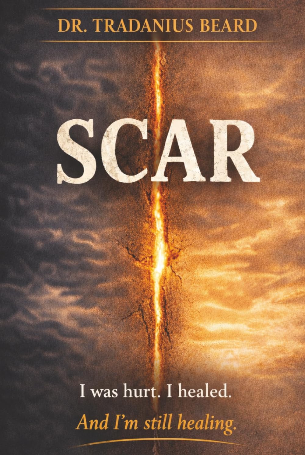 SCAR: I was hurt. I healed. And I'm still healing.