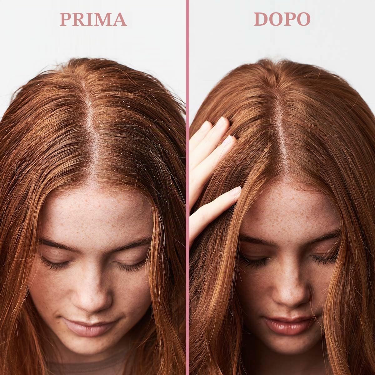 Umberto Giannini Scalp Scrub - Scrub rigenerante esfoliante antiforfora per cuoio capelluto, vegano e non testato sugli animali