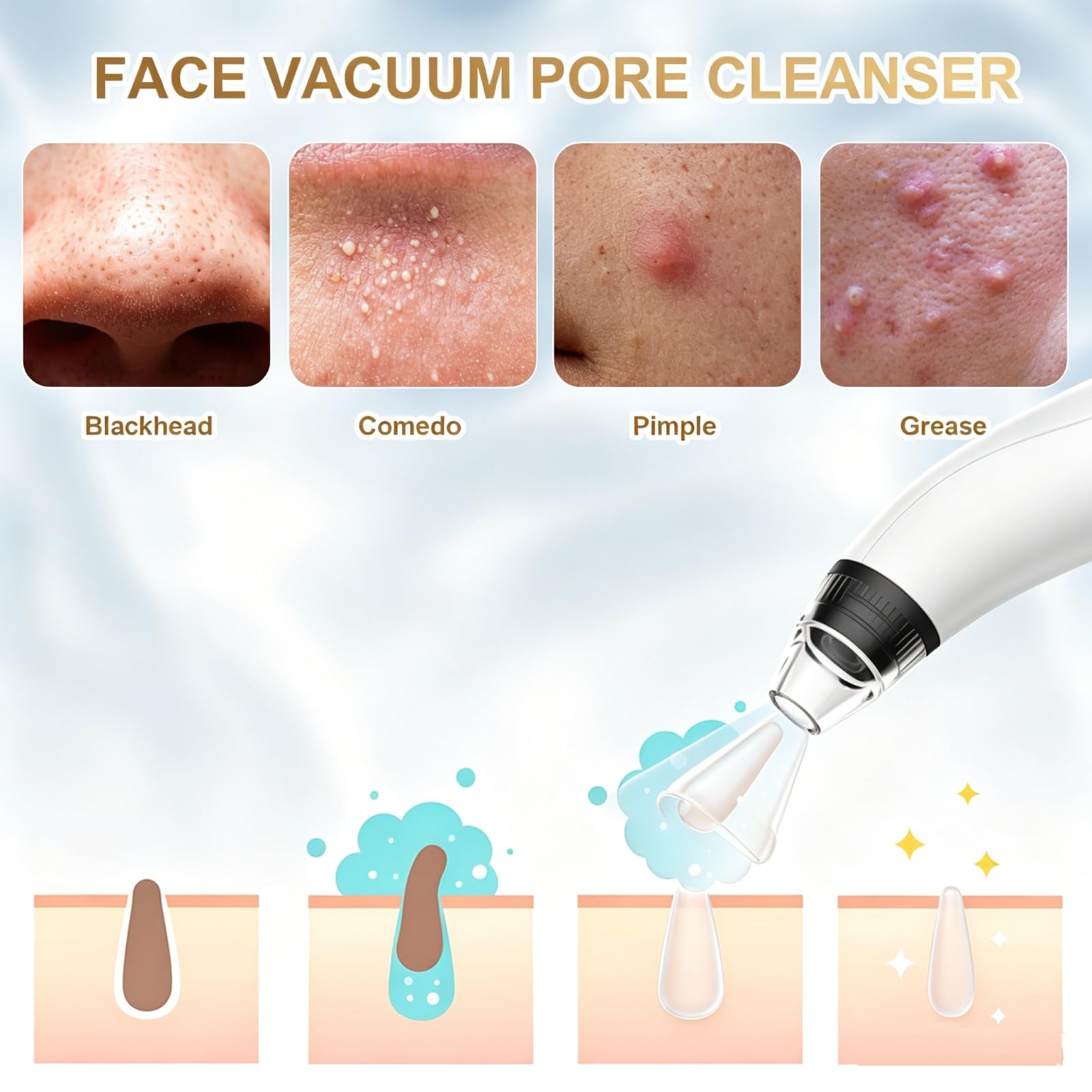 Aooeou Blackhead Remover Tool detail view 5