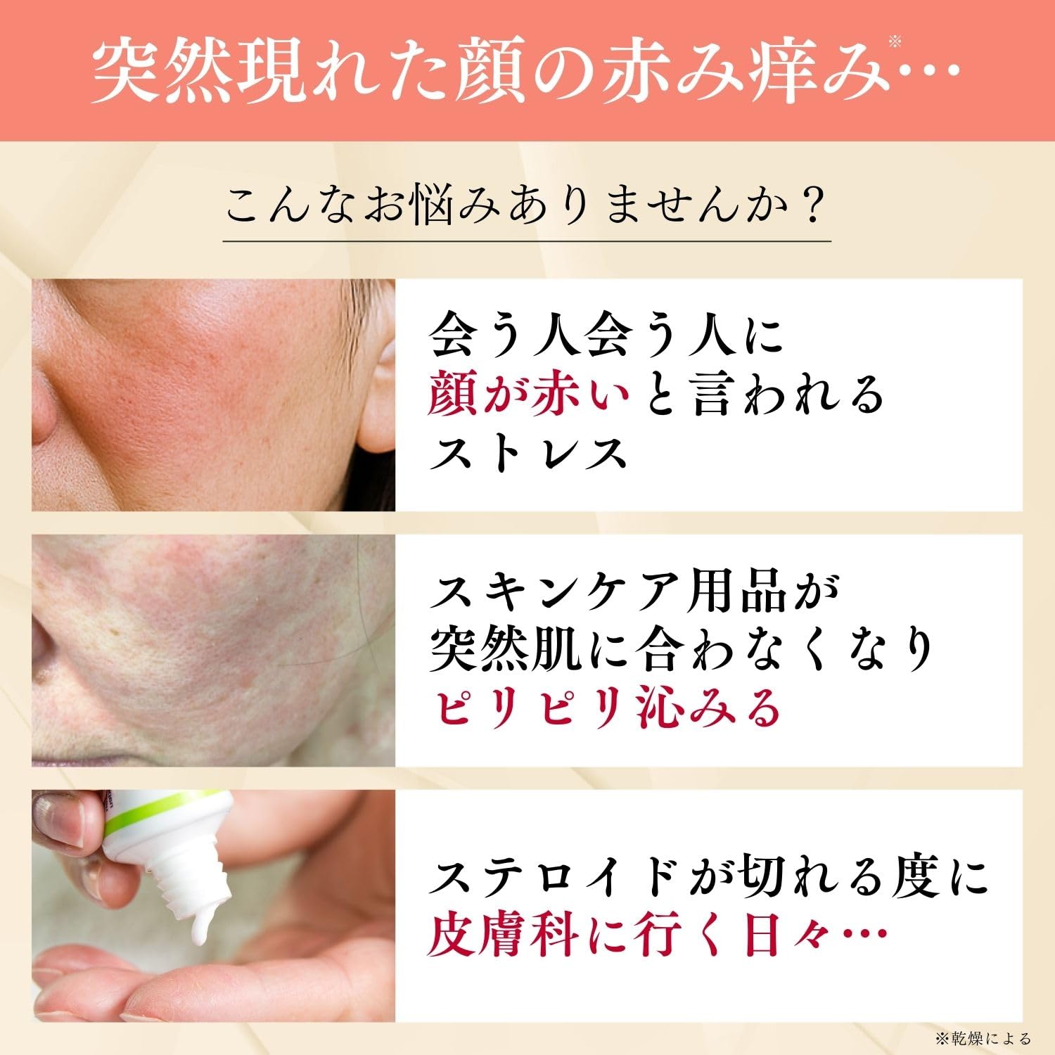 Amazon | 突然の赤み痒みに クレチュール ジュレローションEX ナノミド