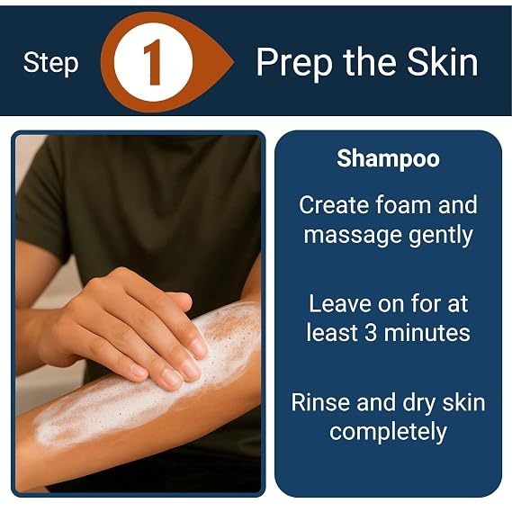 Psoriasis BODY WASH AND SHAMPOO - 8 Oz - Aloe Vera - 2.2% Coal Tar Calms Skin While Softening Scales and Plaques - Salicylic Acid Exfoliates Scalp.