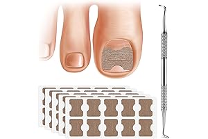 FERYES Ingrown Toenail Patch with Lifter: Redefine Toenail Health